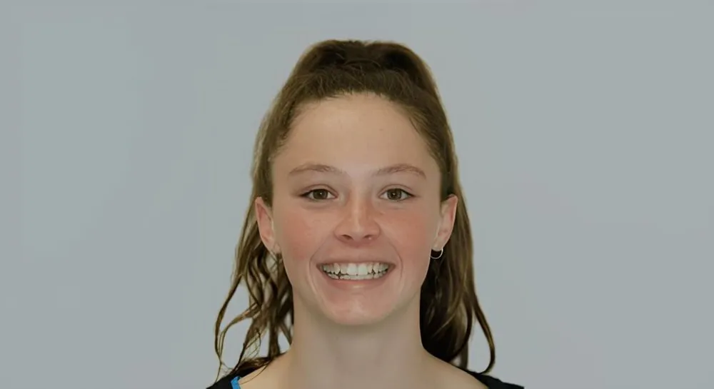 Orthodontics, case 1: before and after, before