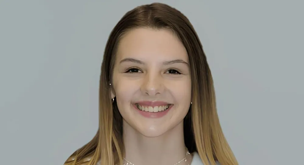 Orthodontics, case 2, smile view: before and after, after