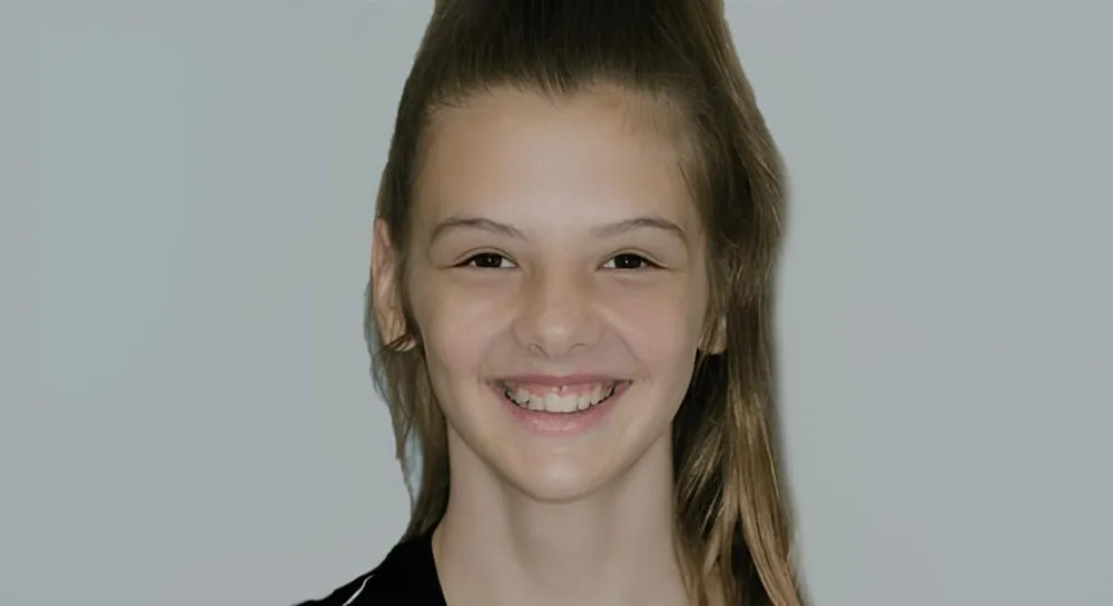 Orthodontics, case 2, smile view: before and after, before