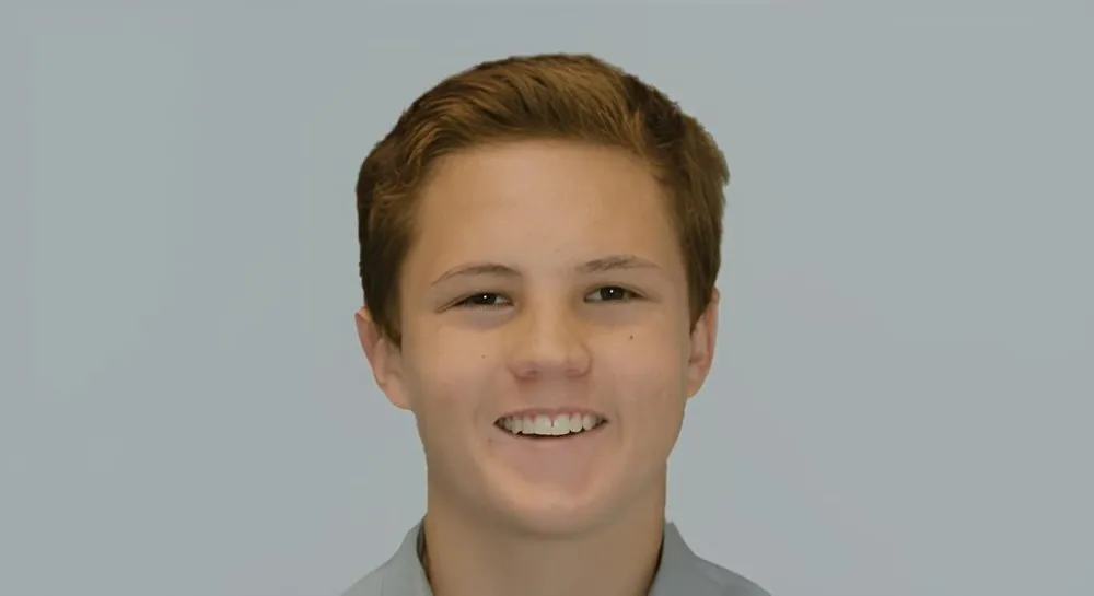 Orthodontics, case 3, smile view: before and after, before