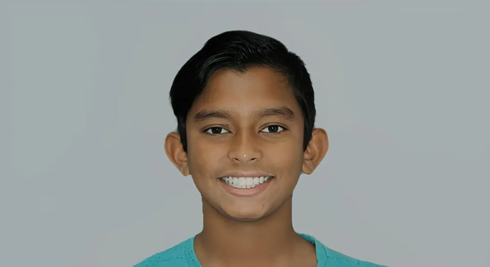 Orthodontics, case 4, smile view: before and after, after