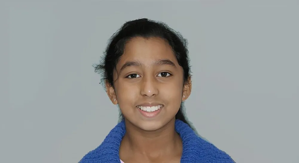 Orthodontic alignment, case 5: before and after, after