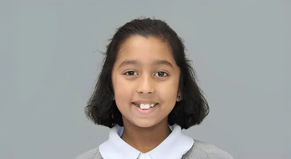Orthodontic alignment, case 5: before and after, before