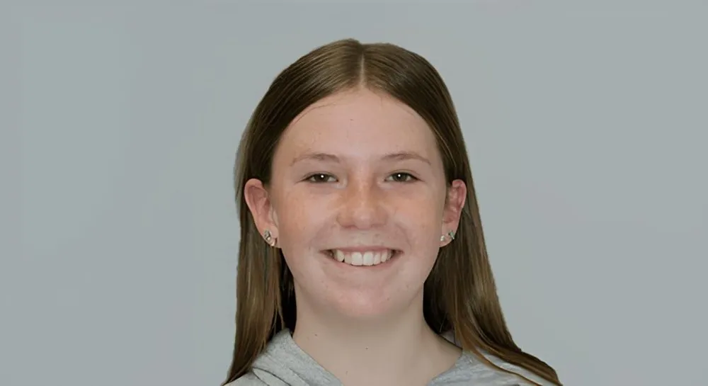 Orthodontics, case 6: before and after, before