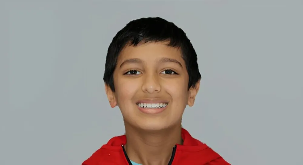 Orthodontics, case 7, smile view: before and after, after