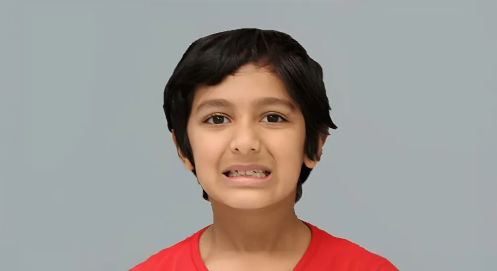 Orthodontics, case 7, smile view: before and after, before