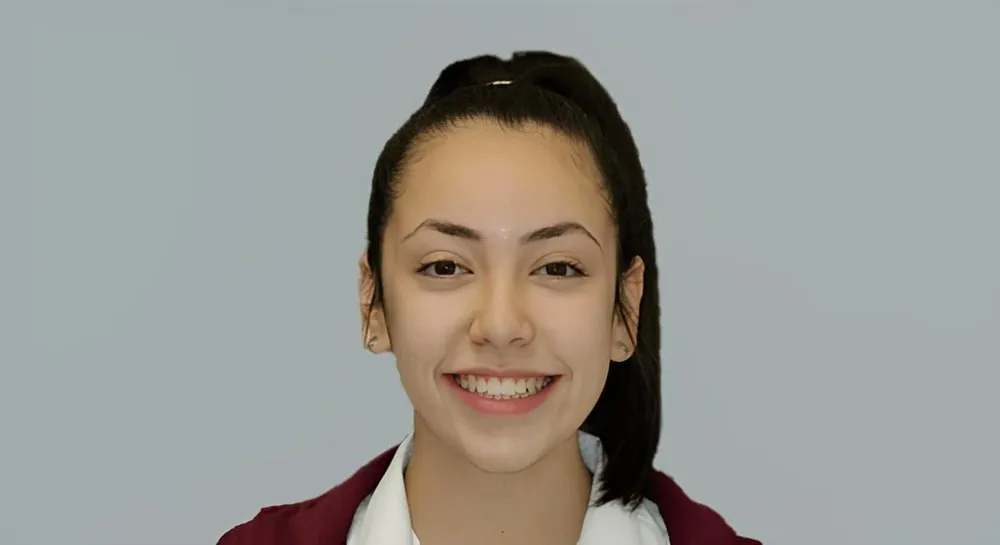 Orthodontic alignment, case 8: before and after, after